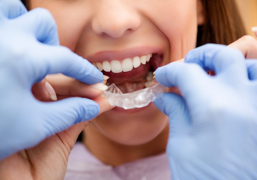 Dentist showing to the female patient how to use mobile orthodontic appliance for dental correction. Close-up.